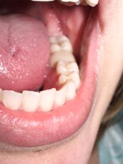 teeth